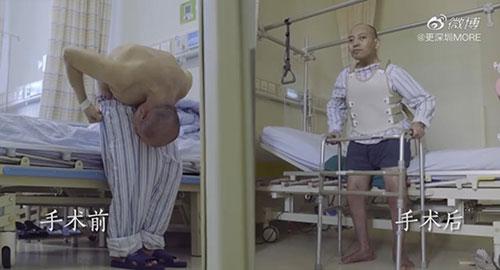 身體被敲斷4次的折疊人出院，打開折疊人生(圖15)